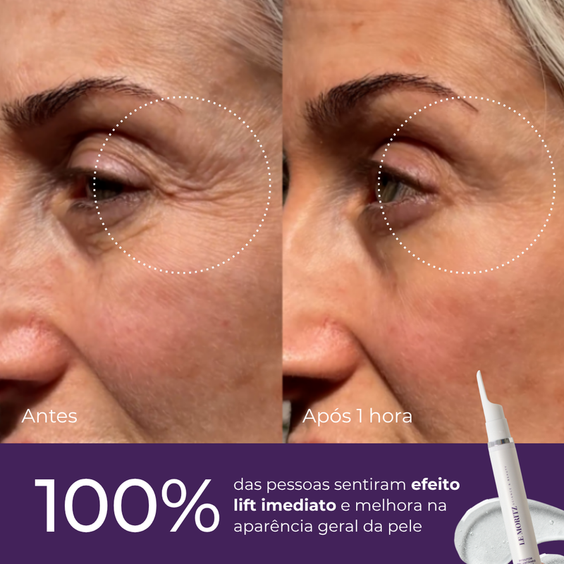Protocolo de Rejuvenescimento